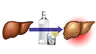 die Auswirkungen von Alkohol auf die Leber
